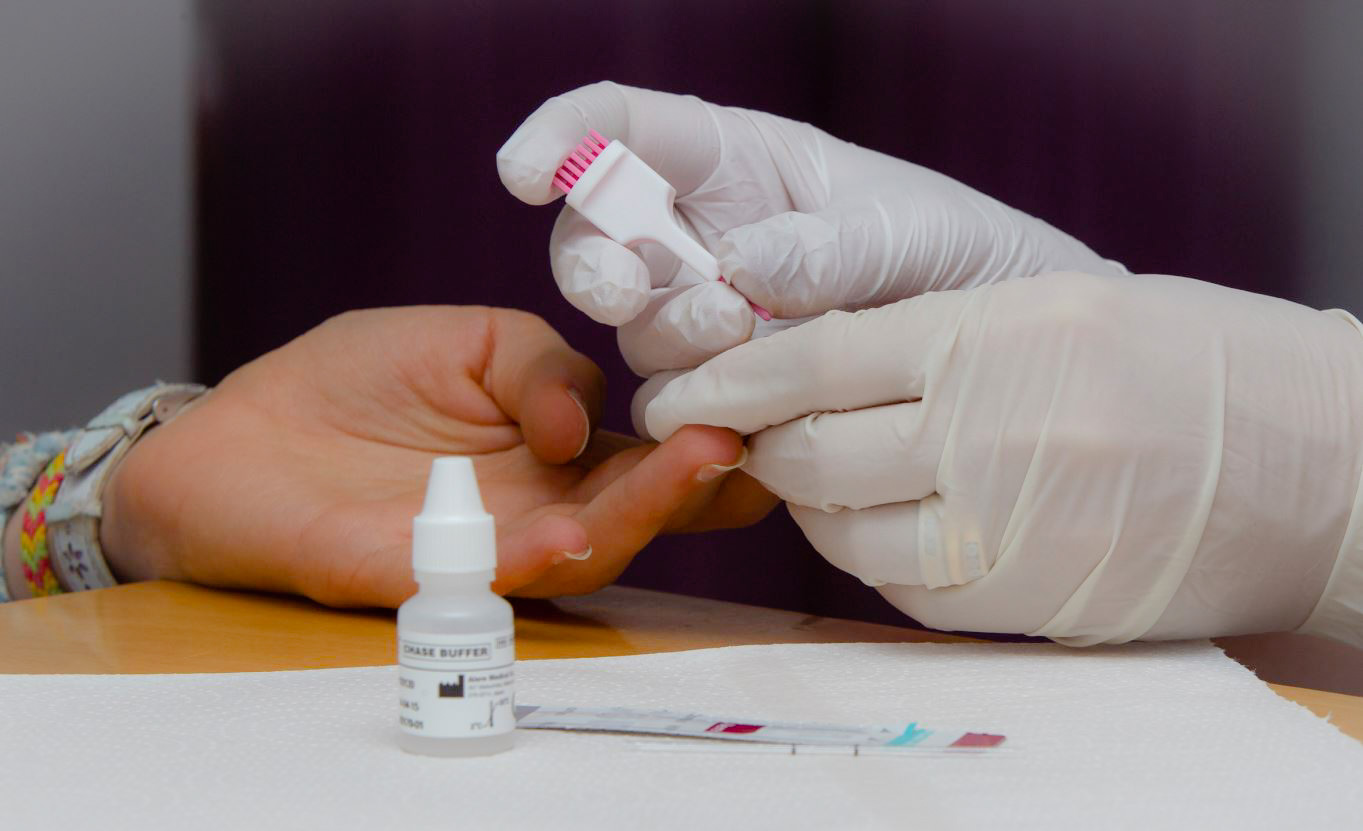 Prova de detecció precoç del VIH a les farmàcies.