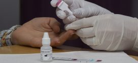 Dia Mundial de la Sida 2018:  Més de 120 farmàcies catalanes realitzen proves per detectar precoçment el risc d’infecció per VIH