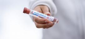 El CCFC adverteix del risc que suposa per a la salut de les persones la proliferació de tests d’antígens sense garanties
